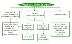 Radiografía simple de cadera